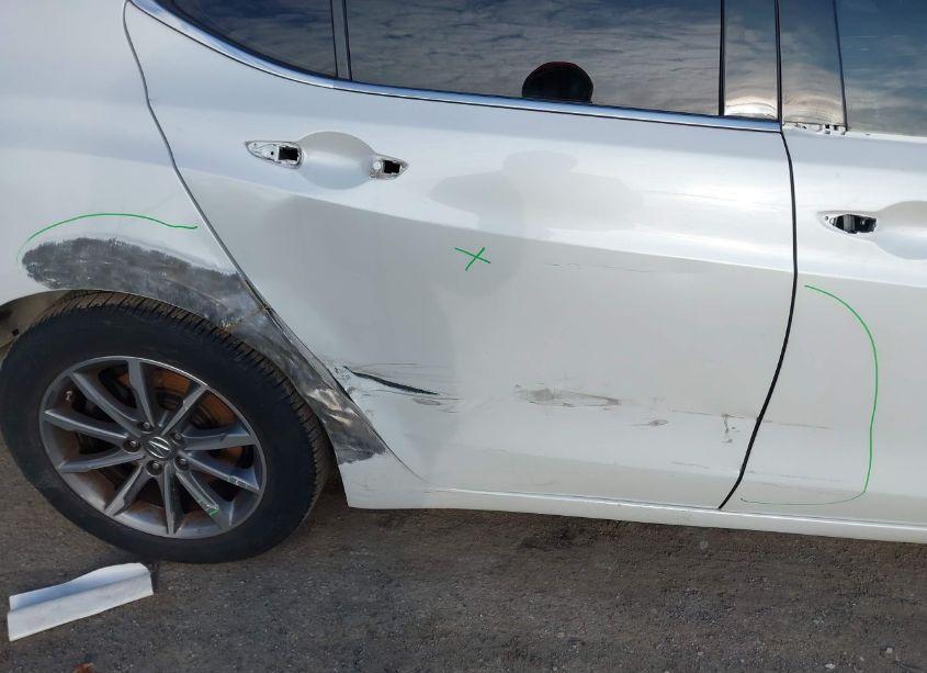 Photo 20 of 2018 Acura Tlx (VIN 19UUB1F33JA004155)