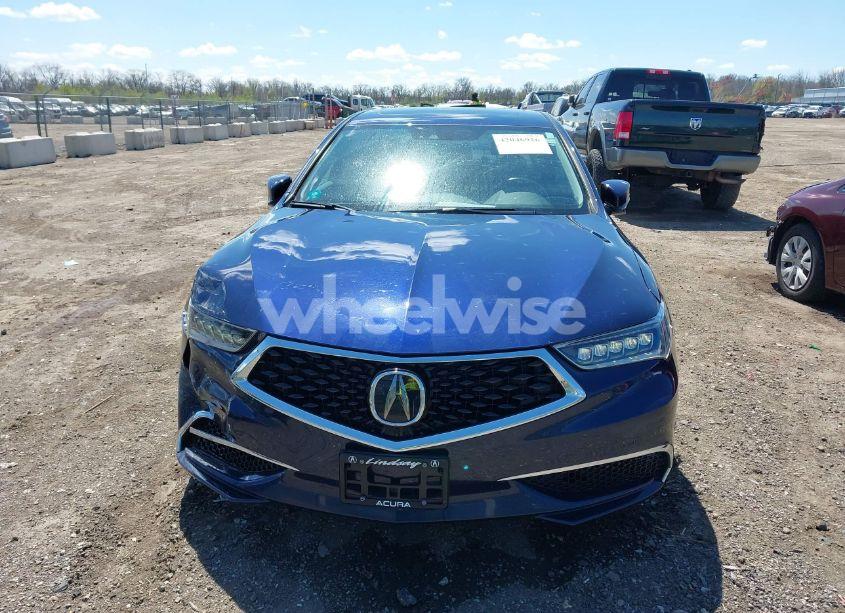 Photo 13 of 2020 Acura Tlx TECH PACKAGE (VIN 19UUB1F51LA001890)