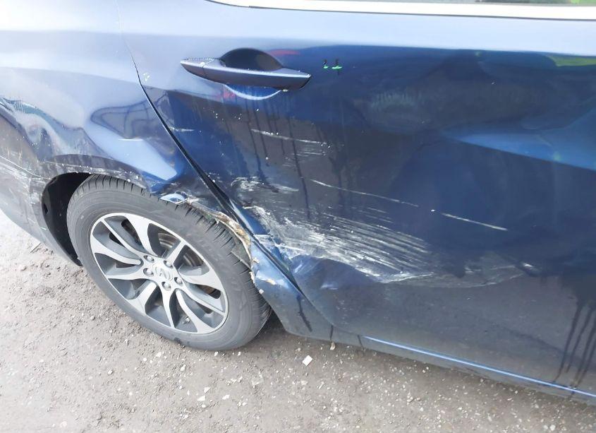 Photo 5 of 2016 Acura Tlx TECH (VIN 19UUB1F54GA015109)