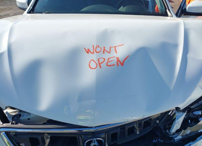 Photo 10 of 2015 Acura Tlx V6 TECH (VIN 19UUB2F56FA012569)