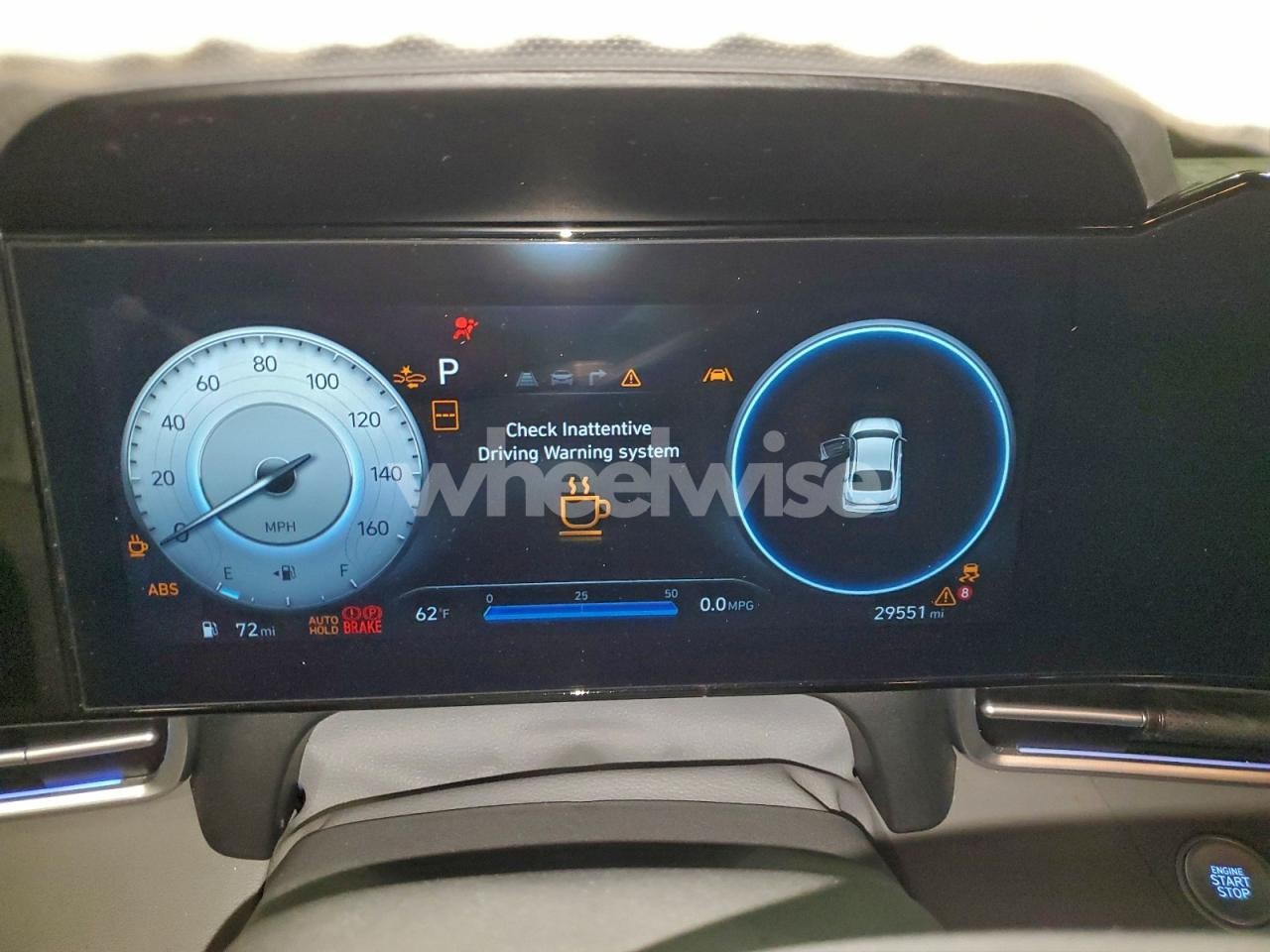 Photo 9 of 2025 HYUNDAI ELANTRA SEL (VIN 19XFB2F5XCE070314)