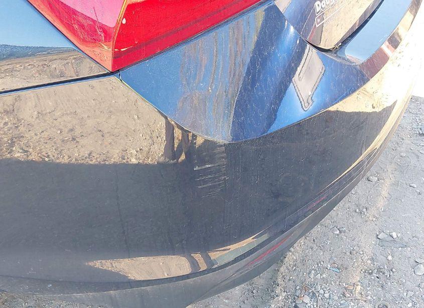 Photo 20 of 2016 Chevrolet Malibu LS (VIN 1G1ZB5ST7GF301600)