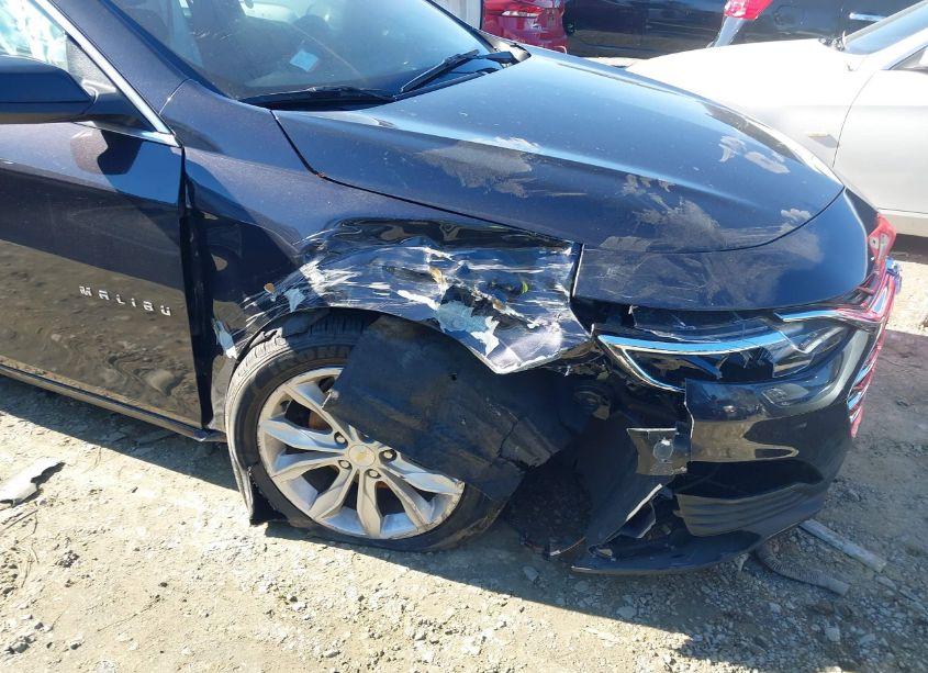 Photo 6 of 2023 Chevrolet Malibu FWD 1LT (VIN 1G1ZD5ST3PF170630)