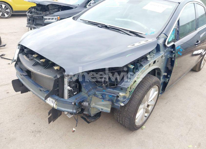 Photo 6 of 2016 Buick Verano CONVENIENCE GROUP (VIN 1G4PR5SK4G4113304)