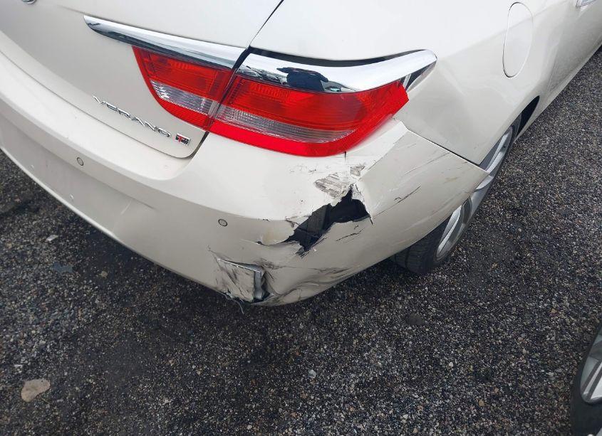 Photo 12 of 2013 Buick Verano PREMIUM GROUP (VIN 1G4PT5SV1D4160636)