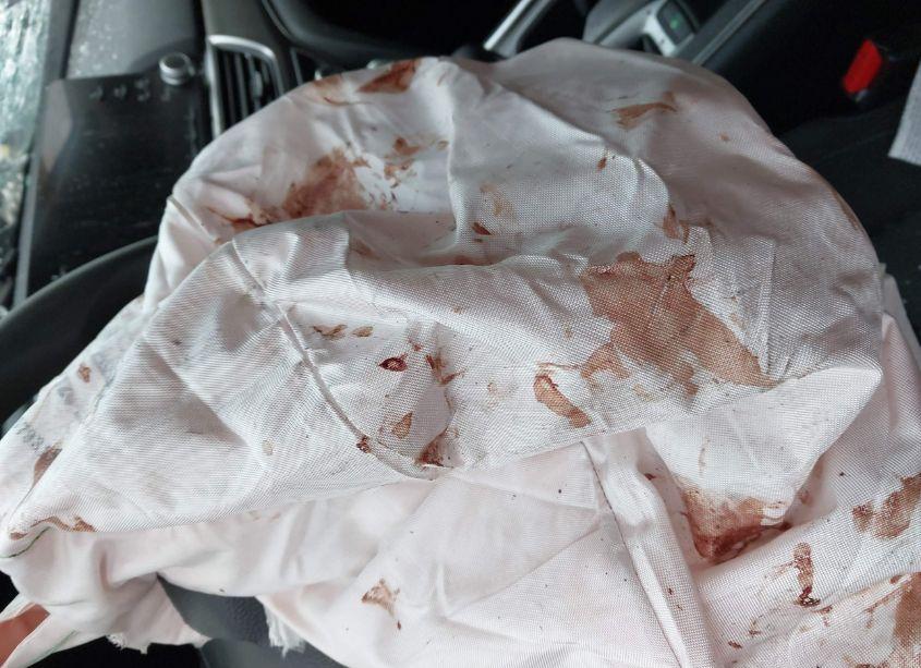 Photo 12 of 2020 Honda Accord LX (VIN 1HGCV1F12LA048118)