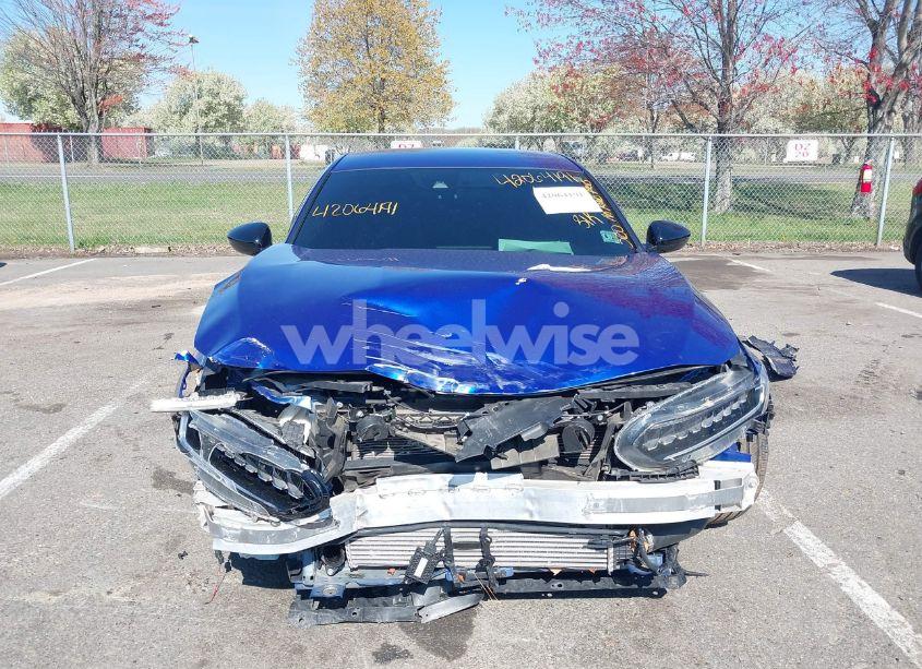 Photo 6 of 2021 Honda Accord SPORT (VIN 1HGCV1F36MA098376)