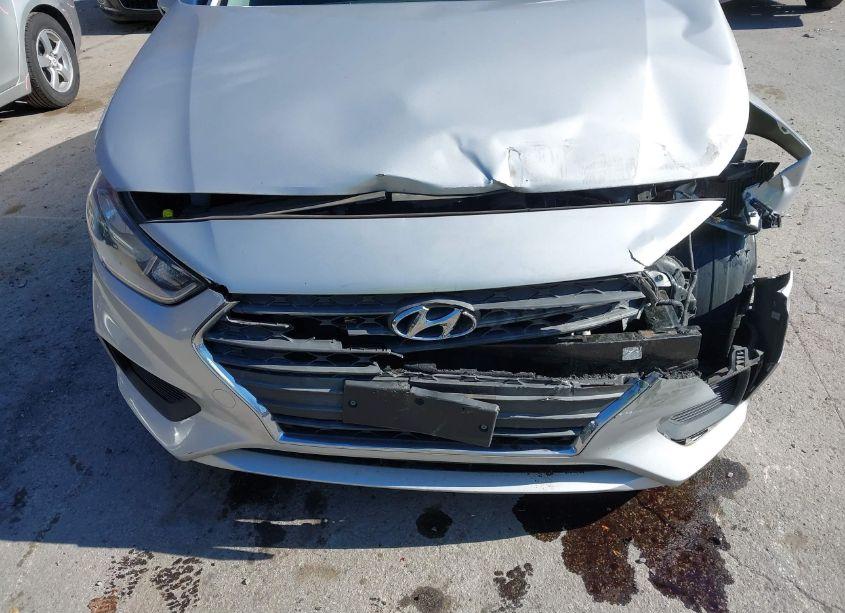 Photo 6 of 2018 Hyundai Accent SE (VIN 3KPC24A32JE005927)