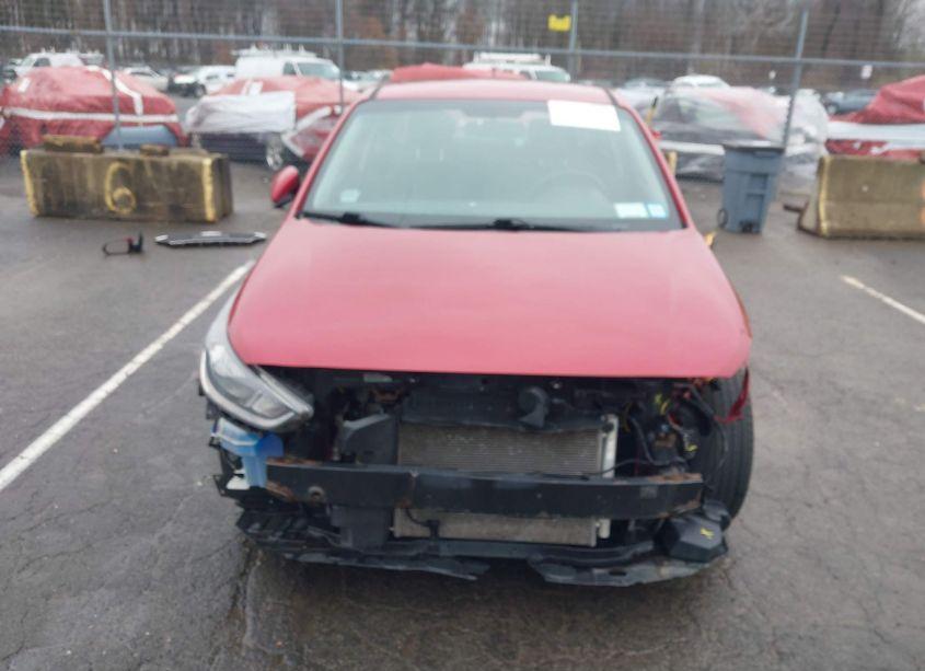 Photo 13 of 2018 Hyundai Accent SE (VIN 3KPC24A38JE025728)