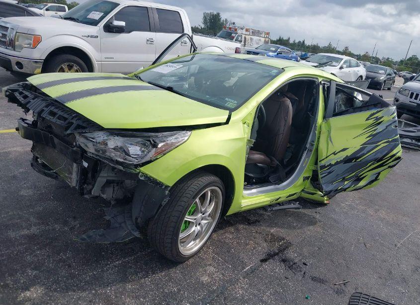 Photo 2 of 2020 Hyundai Accent SE (VIN 3KPC24A64LE097250)