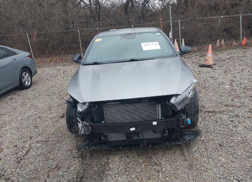 Photo 12 of 2022 Kia Forte GT (VIN 3KPF44AC3NE468902)