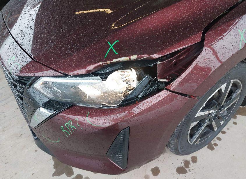 Photo 6 of 2024 Nissan Sentra (VIN 3N1AB8CV2RY206625)