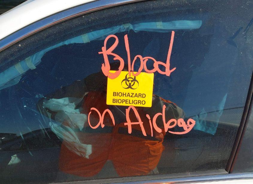 Photo 7 of 2016 Toyota Camry SE (VIN 4T1BF1FK8GU543004)