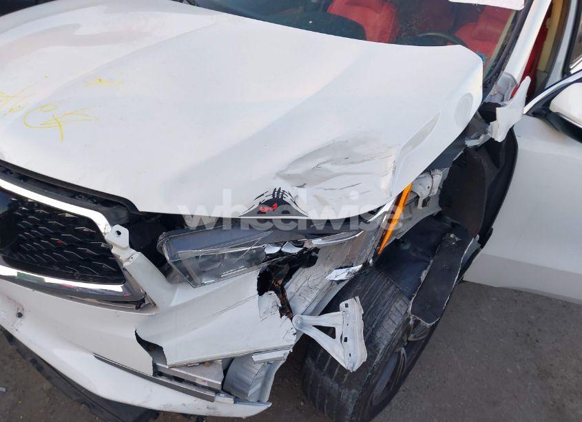 Photo 6 of 2018 Acura Mdx (VIN 5J8YD4H32JL018885)