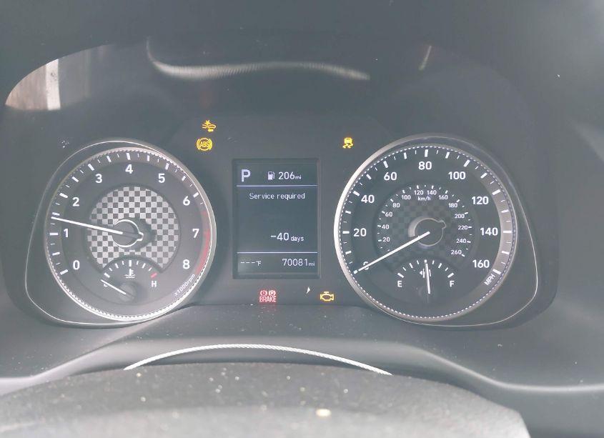 Photo 7 of 2020 Hyundai Elantra SE (VIN 5NPD74LFXLH543514)