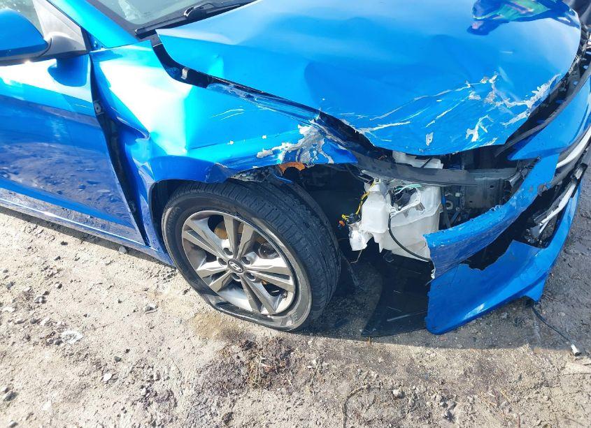 Photo 6 of 2018 Hyundai Elantra SEL (VIN 5NPD84LF2JH354530)