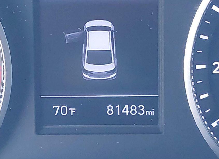 Photo 16 of 2020 Hyundai Elantra SEL (VIN 5NPD84LF2LH534304)