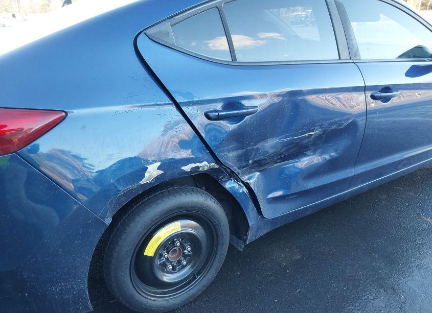 Photo 6 of 2018 Hyundai Elantra SEL (VIN 5NPD84LF3JH245882)