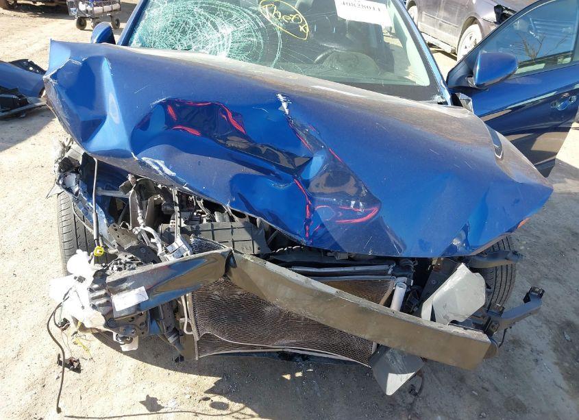 Photo 6 of 2018 Hyundai Elantra SEL (VIN 5NPD84LF4JH263467)