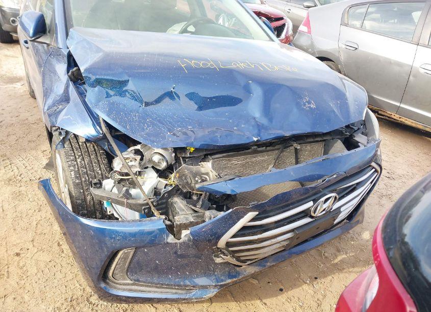 Photo 6 of 2017 Hyundai Elantra SE (VIN 5NPD84LF7HH097939)