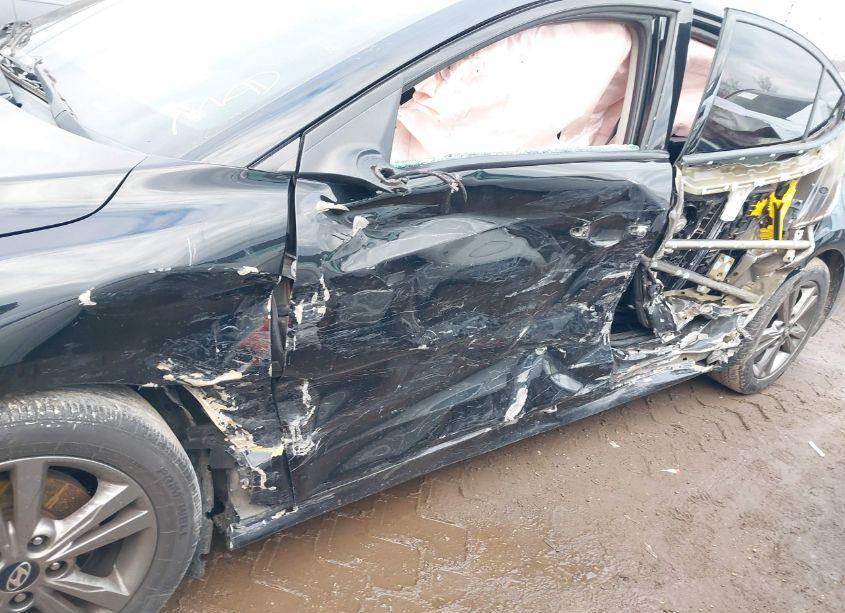 Photo 6 of 2017 Hyundai Elantra SE (VIN 5NPD84LF7HH181839)