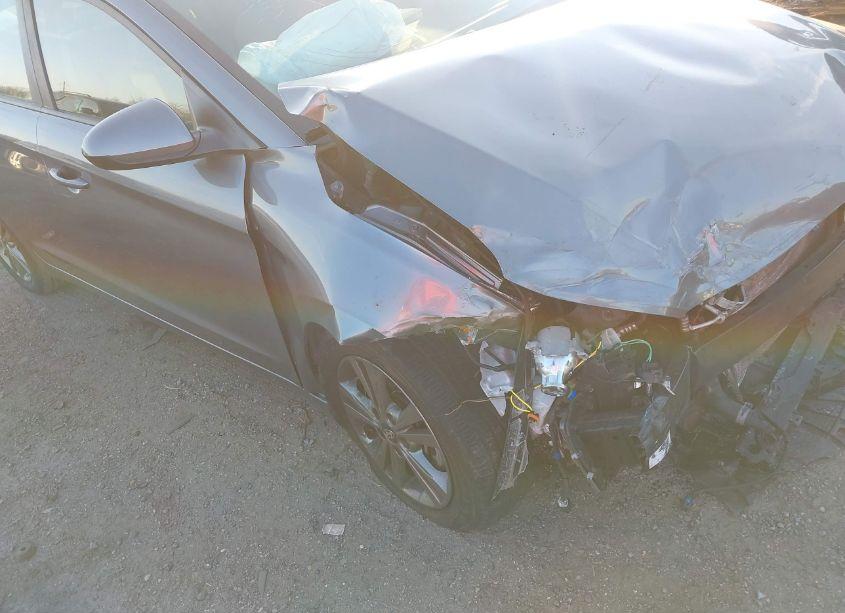 Photo 6 of 2018 Hyundai Elantra SEL (VIN 5NPD84LF7JH329929)