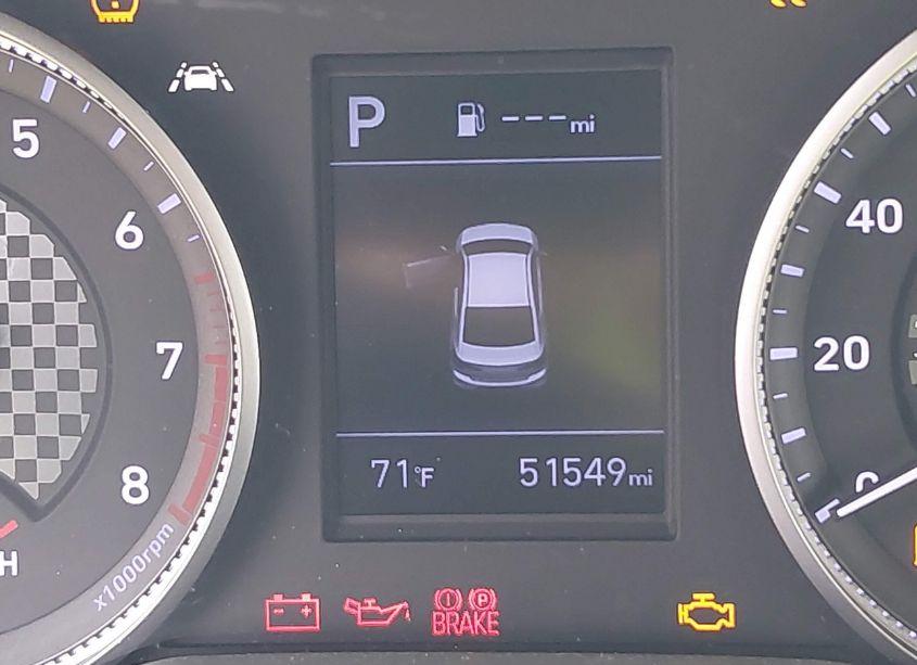 Photo 15 of 2020 Hyundai Elantra SEL (VIN 5NPD84LF9LH519900)