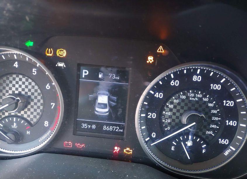 Photo 16 of 2020 Hyundai Elantra SEL (VIN 5NPD84LFXLH579619)