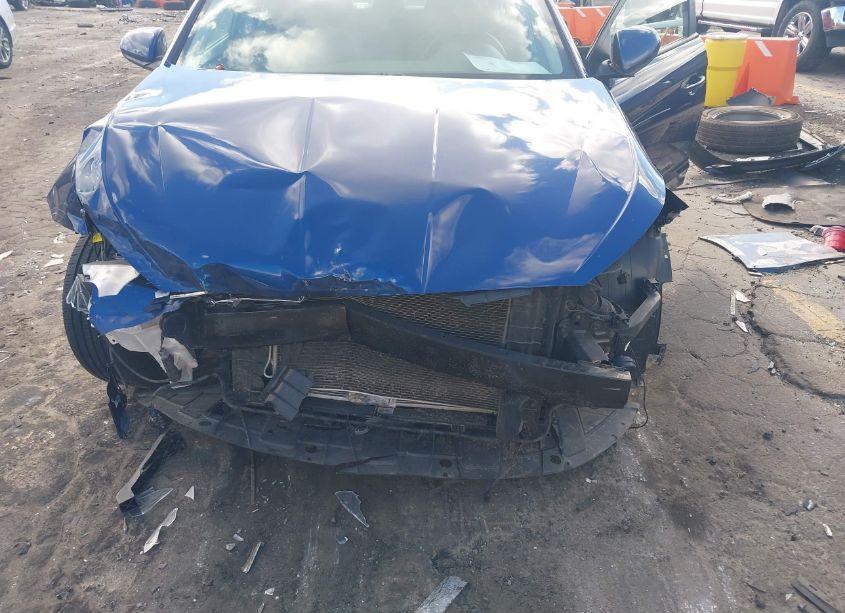 Photo 6 of 2020 Hyundai Elantra SEL (VIN 5NPD84LFXLH632805)