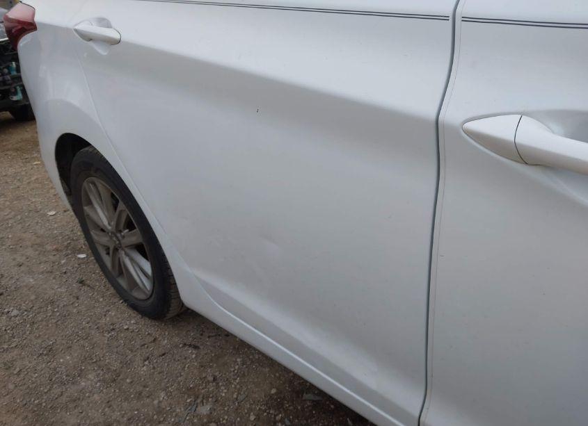 Photo 20 of 2015 Hyundai Elantra SE (VIN 5NPDH4AE0FH589185)