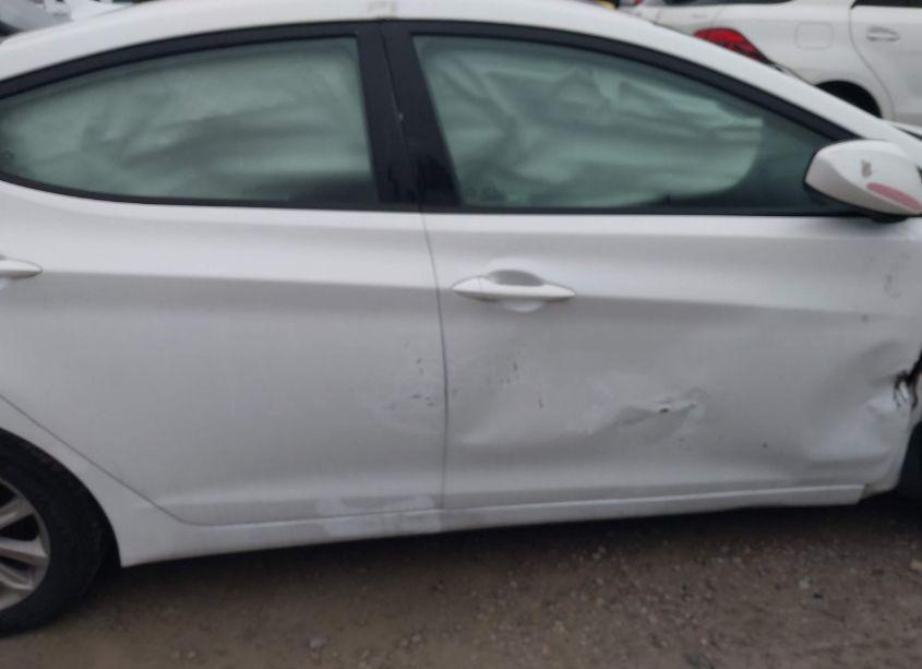 Photo 14 of 2015 Hyundai Elantra SE (VIN 5NPDH4AE0FH604641)