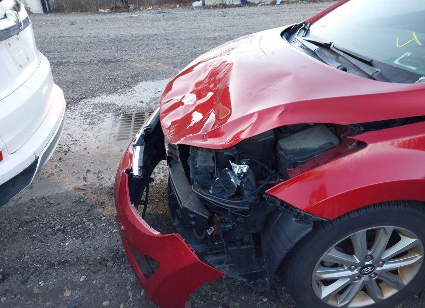 Photo 17 of 2016 Hyundai Elantra SE (VIN 5NPDH4AE0GH694181)