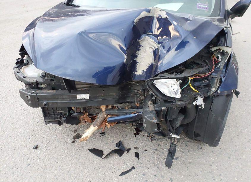 Photo 6 of 2011 Hyundai Elantra GLS (VIN 5NPDH4AE1BH022526)