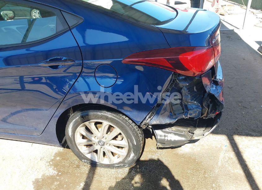 Photo 6 of 2015 Hyundai Elantra SE (VIN 5NPDH4AE1FH552551)