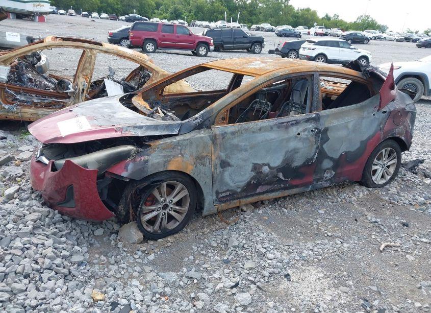 Photo 2 of 2016 Hyundai Elantra SE (VIN 5NPDH4AE1GH706662)