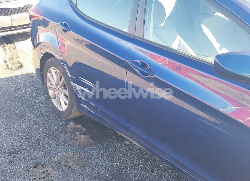 Photo 6 of 2016 Hyundai Elantra SE (VIN 5NPDH4AE1GH720562)