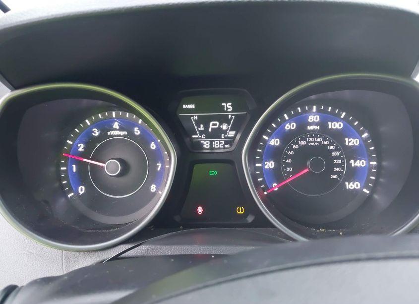 Photo 7 of 2015 Hyundai Elantra SE (VIN 5NPDH4AE2FH580326)