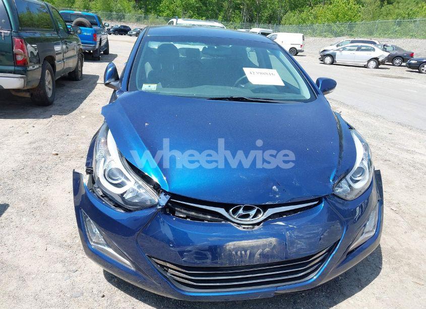 Photo 6 of 2015 Hyundai Elantra LIMITED (VIN 5NPDH4AE3FH615004)