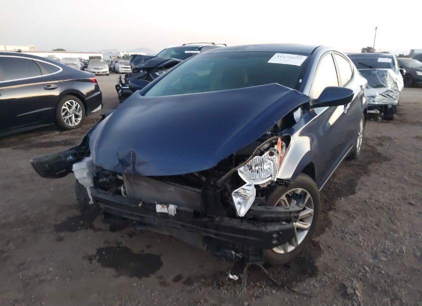 Photo 6 of 2015 Hyundai Elantra SE (VIN 5NPDH4AE3FH618548)