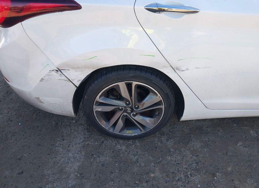 Photo 17 of 2015 Hyundai Elantra LIMITED (VIN 5NPDH4AE3FH623460)