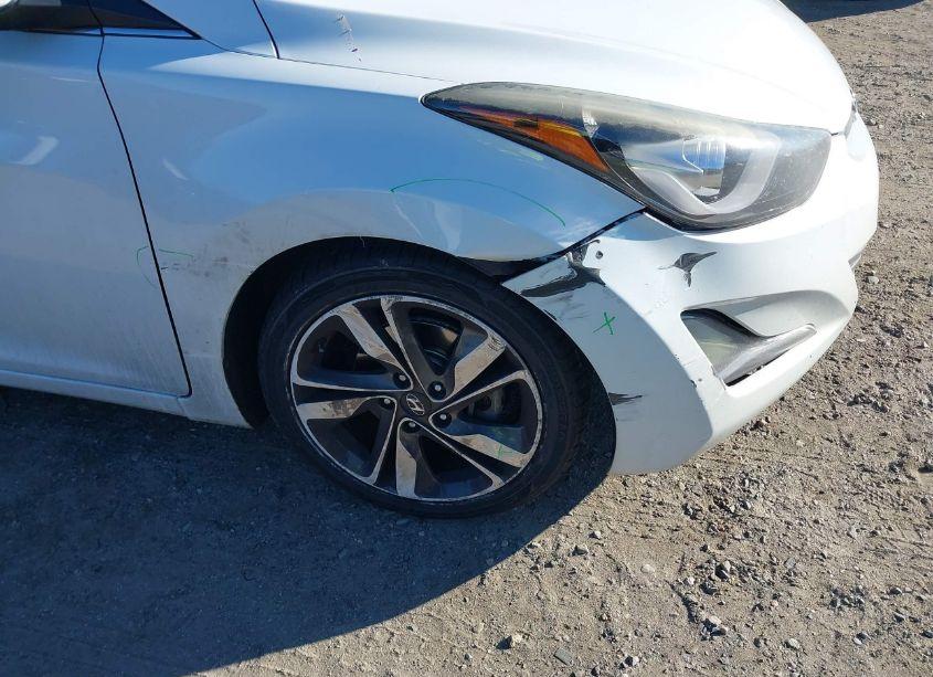 Photo 6 of 2015 Hyundai Elantra LIMITED (VIN 5NPDH4AE3FH623460)