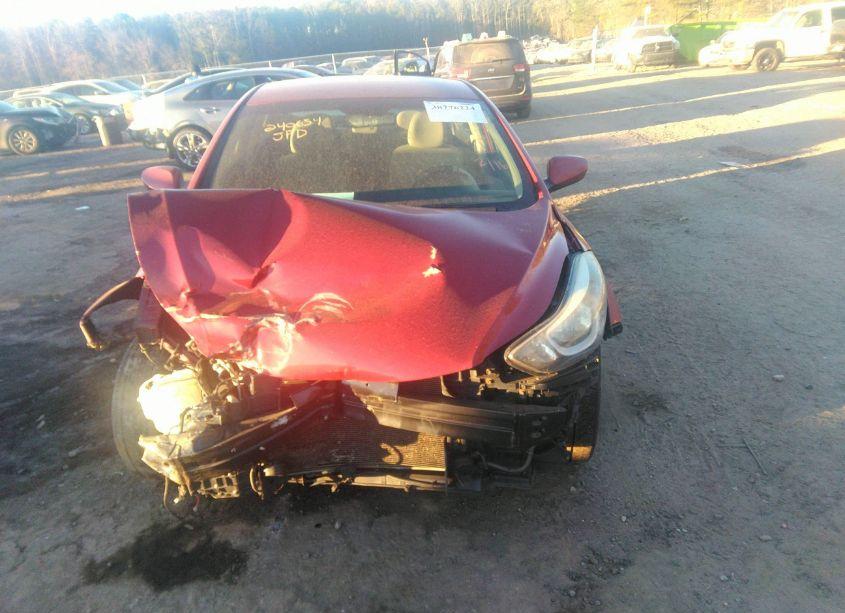 Photo 11 of 2014 Hyundai Elantra SE (VIN 5NPDH4AE4EH469212)