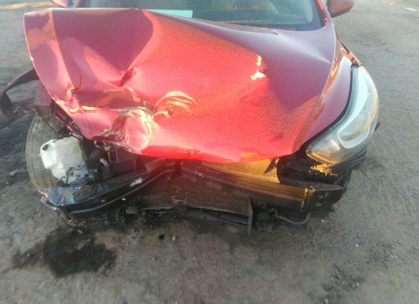 Photo 6 of 2014 Hyundai Elantra SE (VIN 5NPDH4AE4EH469212)