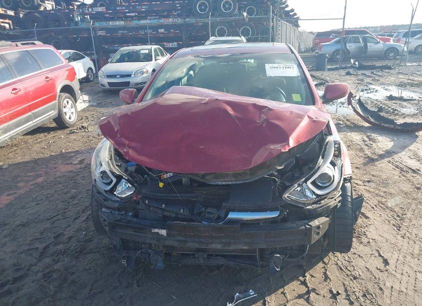 Photo 11 of 2015 Hyundai Elantra SE (VIN 5NPDH4AE4FH553886)