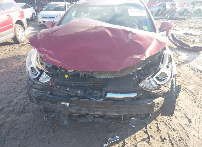 Photo 6 of 2015 Hyundai Elantra SE (VIN 5NPDH4AE4FH553886)