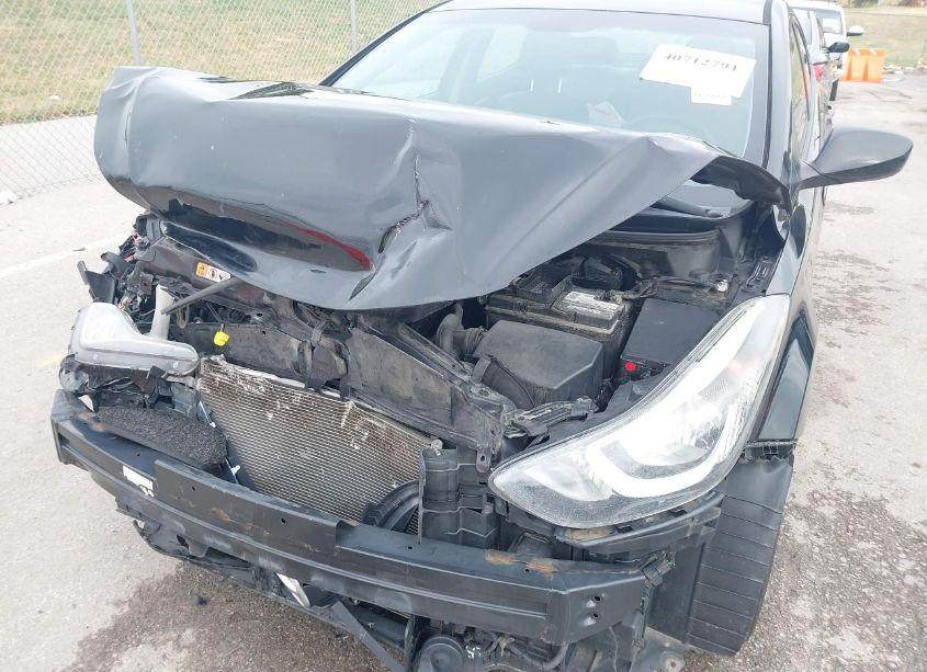 Photo 18 of 2015 Hyundai Elantra SE (VIN 5NPDH4AE4FH606408)