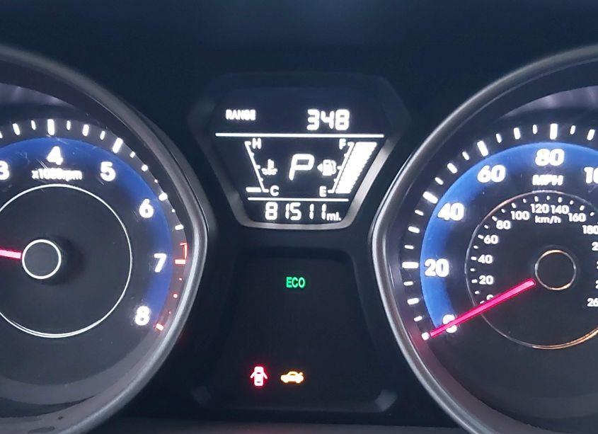 Photo 7 of 2016 Hyundai Elantra SE (VIN 5NPDH4AE4GH697018)