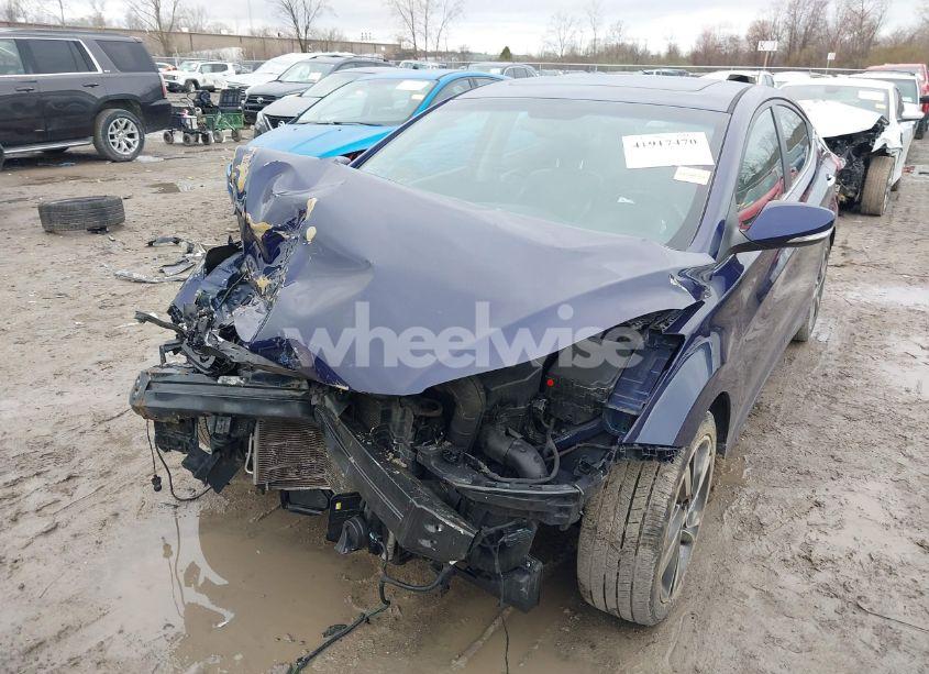 Photo 6 of 2014 Hyundai Elantra LIMITED (VIN 5NPDH4AE5EH535878)