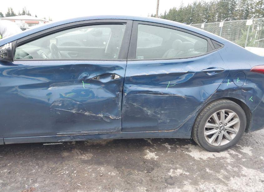 Photo 6 of 2016 Hyundai Elantra SE (VIN 5NPDH4AE5GH658924)