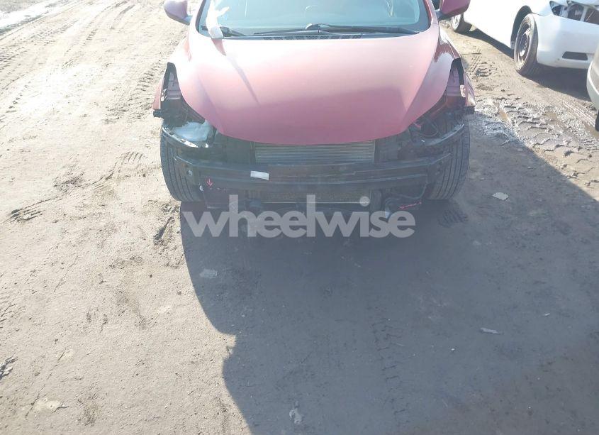 Photo 6 of 2016 Hyundai Elantra SE (VIN 5NPDH4AE5GH720502)